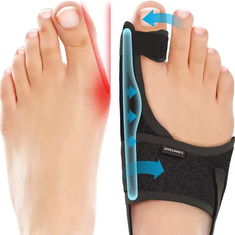 Verstelbare Teenspalk voor Nachts – Ergonomische Correctie voor Links en Rechts | Sansoti