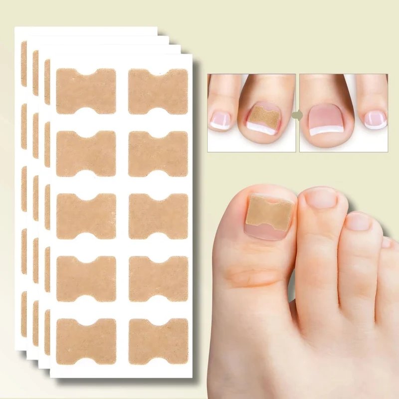 10+10 GRATIS | FixaNail - Directe Nagelreparatie